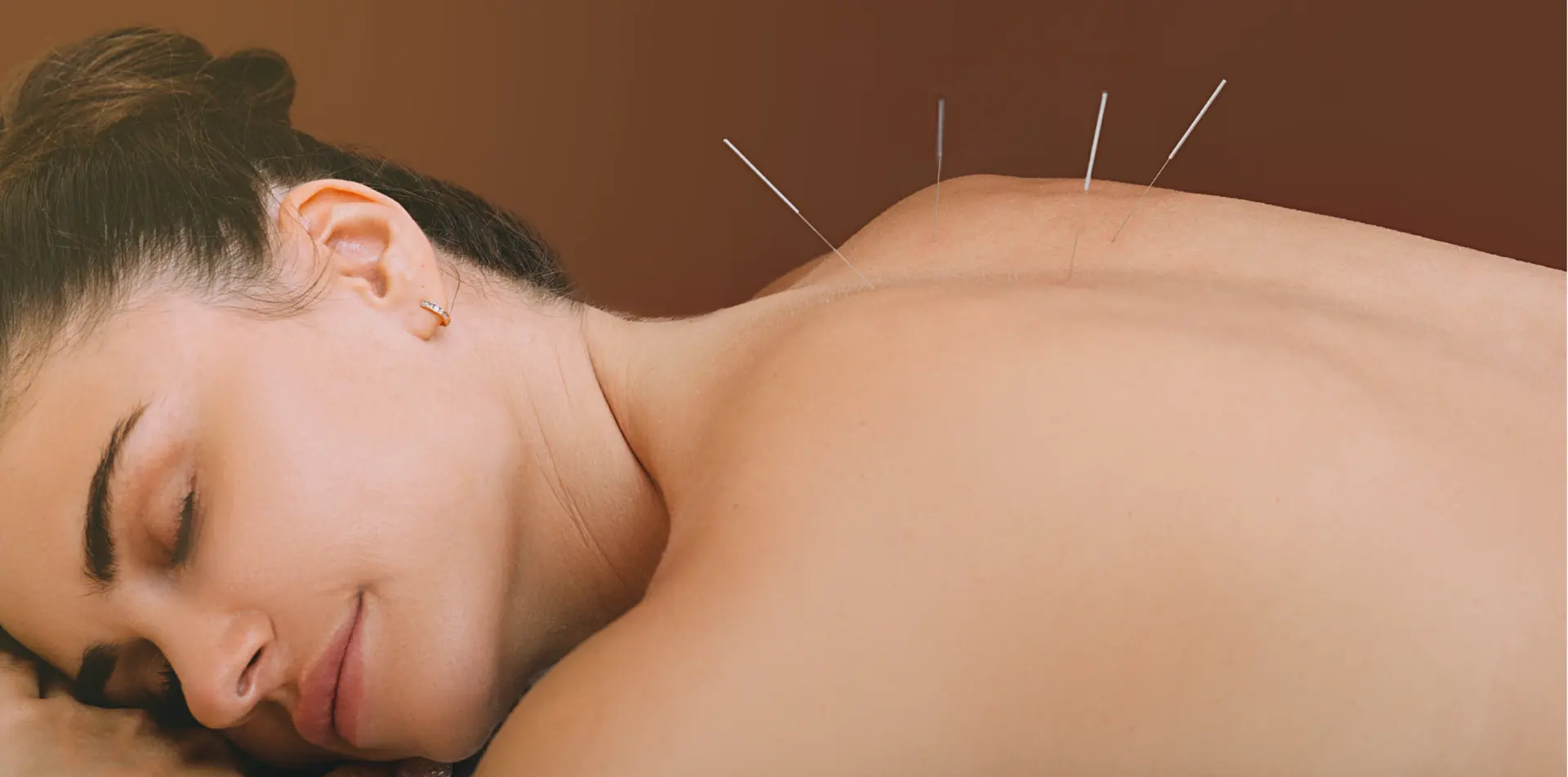 relaxing Acupuncture Laura paris Capitola CA